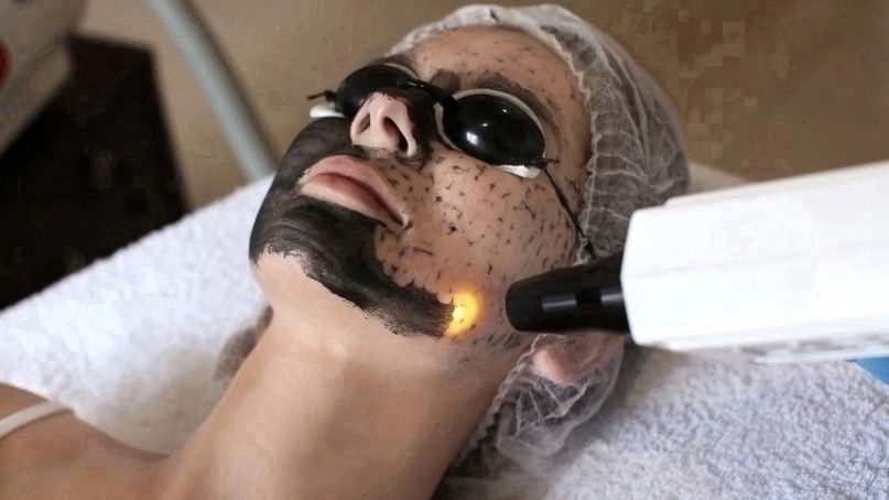 Skin One X